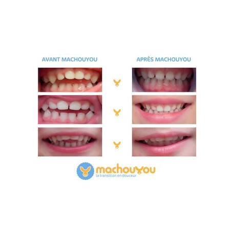 Machouyou Dispositif 1ères dents Prune dés 2 ans VIOLET 3 - vertbaudet enfant 